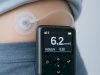 Welcome to Aidex CGM: Revolutionizing Diabetes Care with Automatic Pumps for Insulin Dependent Patients
