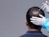 Can Minoxidil Help Regrow Hair? Detailed Insights for Men and Women