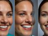 Transform Your Smile with Porcelain Veneers: A Complete Guide