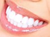 How Much Does a Bright Smile Teeth whitening Cost?