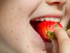 How Accurate are Food Allergy Tests in Dubai?