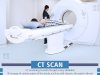 How to Choose the Right MRI Spine Services Near Solan