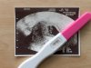 Early Pregnancy Scan: An Ultimate Guide