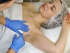 Is Underarms Botox a Permanent Sweating Solution?
