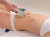 How Many Sessions Are Needed for Exilis Treatment?