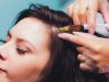 Tackle Hair Thinning with the Cheapest PRP Treatment in Dubai