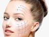 Common Concerns About Thread Lift in Islamabad