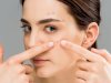 When Does Acne Treatment Dubai Show Real Results?