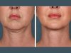 Best Doctors in Dubai for Affordable PRP Treatment