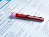 What Makes a Full STD Panel Different From At-Home Tests?