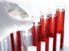 Hepatitis C Test and Public Health: Why Widespread Screening Matters