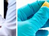What Doctors Look For in a Chlamydia Test?
