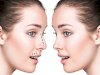 Best Rhinoplasty Surgeons in Dubai: Clinical Judgment Counts