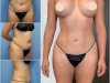 Best Doctors in Dubai for Body Contouring and Body Reshaping Excellence