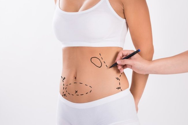 Sculpted Secrets: The Liposuction Obsession Behind the Glamour