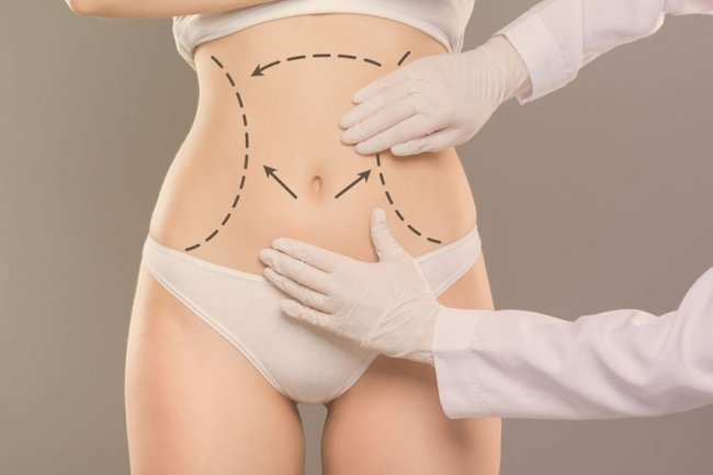 Tummy Tuck Surgery in Dubai - Your Path to a Confident You