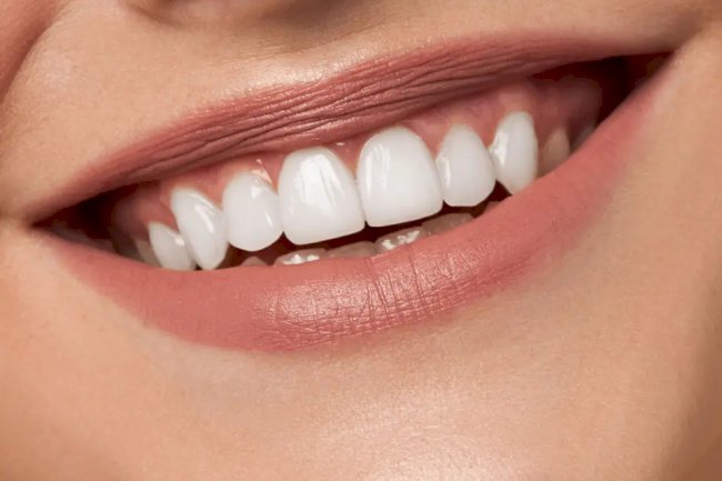 Does Teeth Whitening Work on Naturally Gray Teeth?