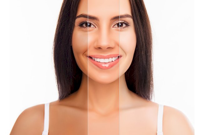 Comparing Popular Whitening Brands Used in Islamabad
