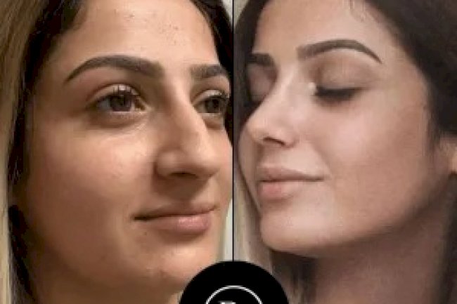 Top 10 Best Aesthetic Clinics in Dubai for Skin and Beauty