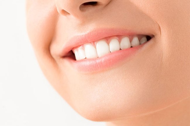 How Teeth Whitening Cost Matches Expectations