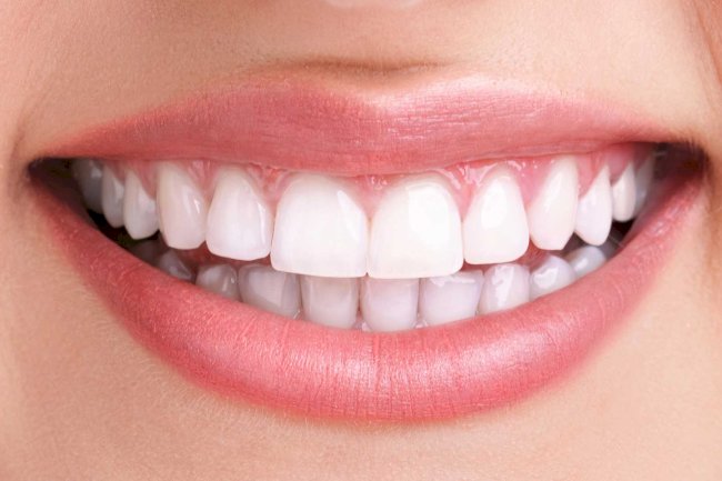 Teeth Whitening Cost: Is It Cheaper With Insurance?