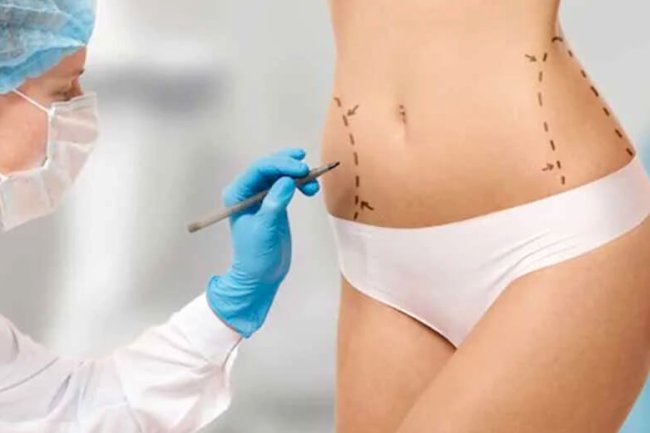 The Truth About Liposuction in Islamabad