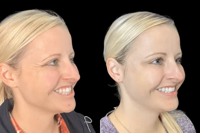 Why the Best Aesthetic Clinics in dubai Are Leading the Botox Industry