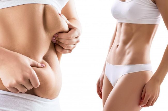 Essential Advice from the Best Liposuction Surgeon in Dubai