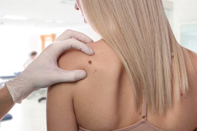 Fresh Start with Tag Removal Dubai