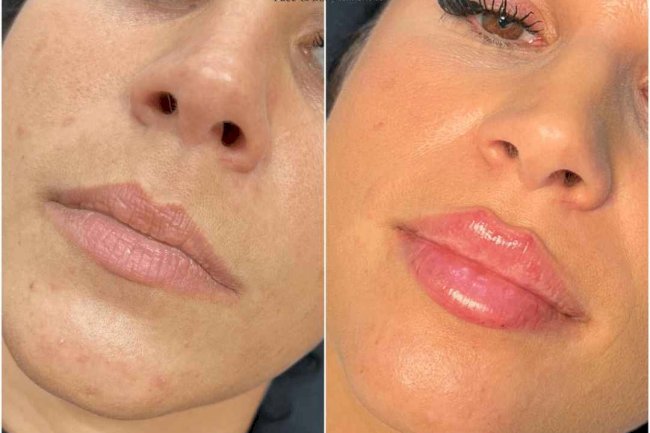 Best Plastic Surgeon in Dubai: Liposuction Techniques You Should Know