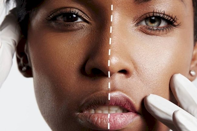 Skin Whitening in Islamabad: Cultural and Religious Considerations
