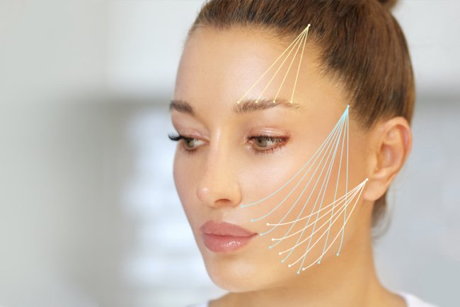 What to Expect Before, During, and After a Thread Lift Treatment in Dubai