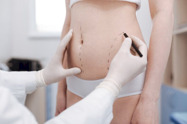 Speeding Up Your Recovery After Liposuction Riyadh