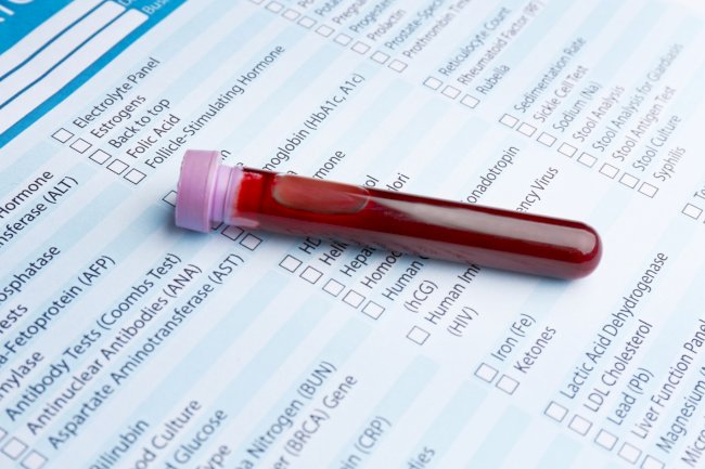 What Makes a Full STD Panel Different From At-Home Tests?