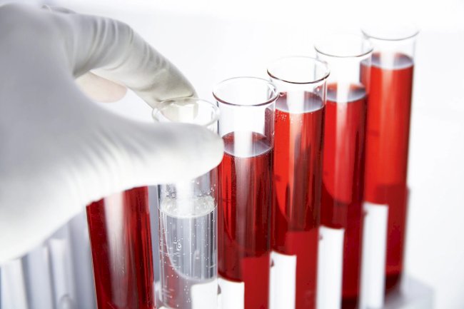 Hepatitis C Test and Public Health: Why Widespread Screening Matters