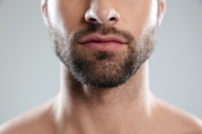 How to Plan Your Beard Hair Transplant in Islamabad Step by Step