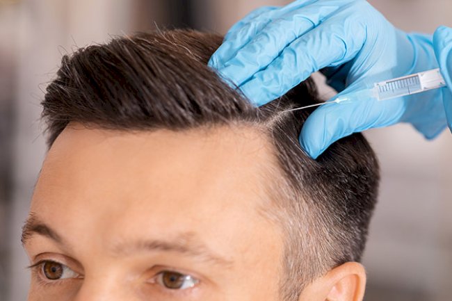 Hidden Costs to Ask About Before Booking a Hair Transplant