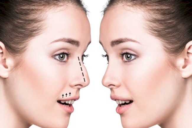 Best Rhinoplasty Surgeons in Dubai: Clinical Judgment Counts