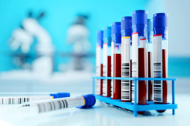 Signs You Shouldn’t Ignore That May Indicate the Need for Syphilis Screening