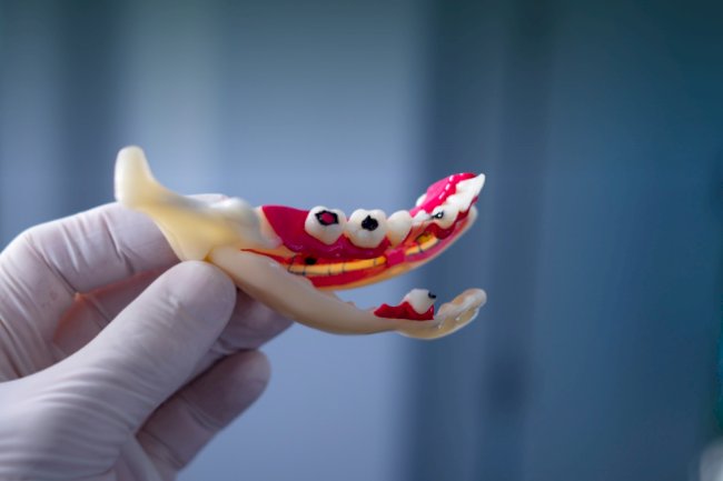 How Lifestyle Habits Affect Your Teeth and Gums