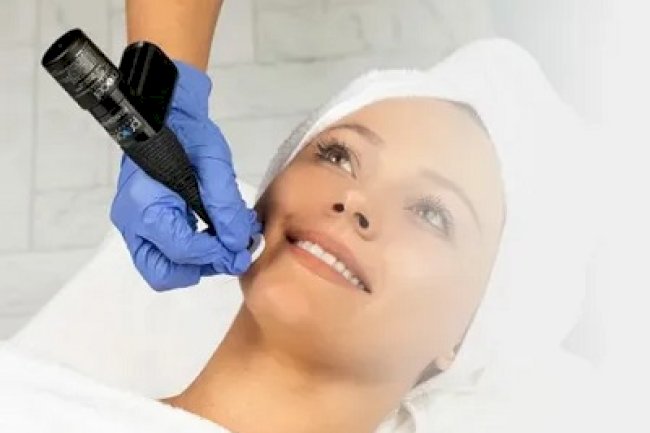 Microchanneling Treatment Benefits for Healthier Skin