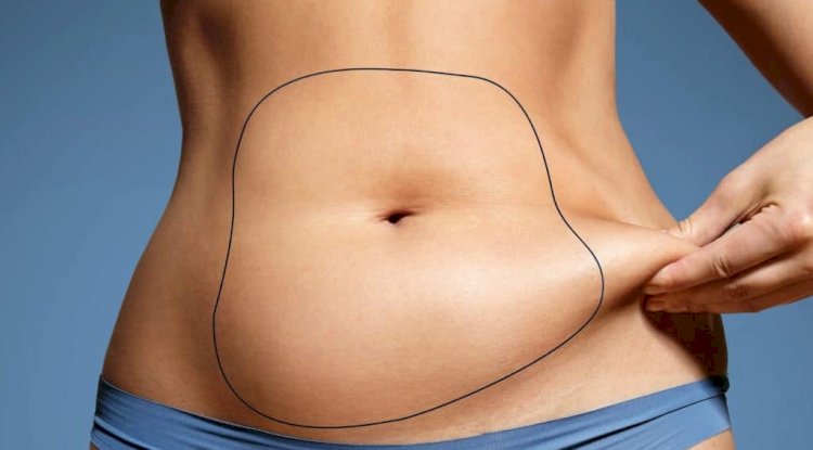Expert Recovery Guidance from Best Liposuction Surgeons in Dubai