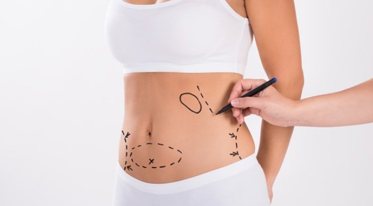 Sculpted Secrets: The Liposuction Obsession Behind the Glamour