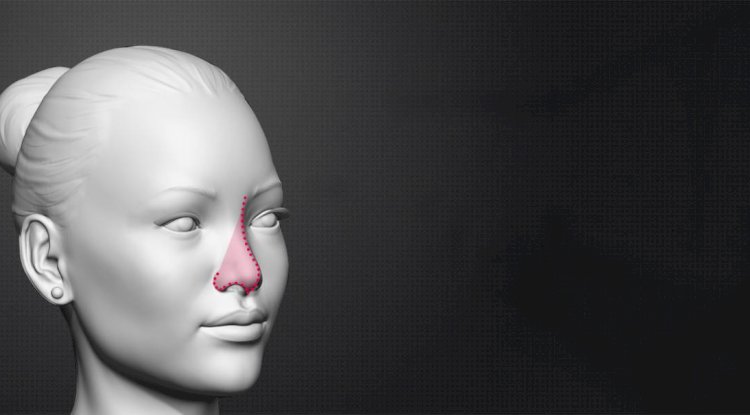 Common Fears About Facial Feminization Surgery