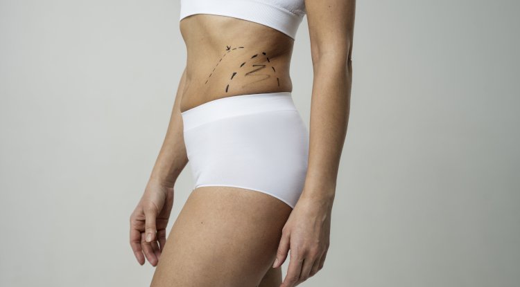 Liposuction in Dubai Demystified The Essential Guide to a Sleeker You