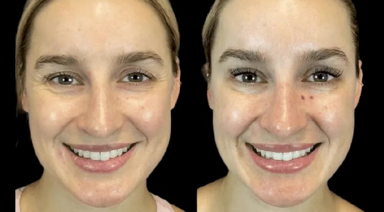 First-Time at the Best Aesthetic Clinic in Dubai? Here’s What to Know Before You Go