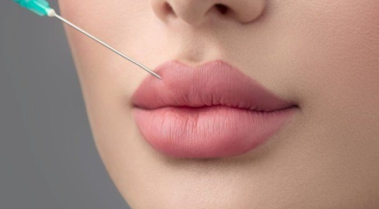 How the Best Aesthetic Clinic in Dubai Creates Perfect Lip Contours with Russian Lip Fillers