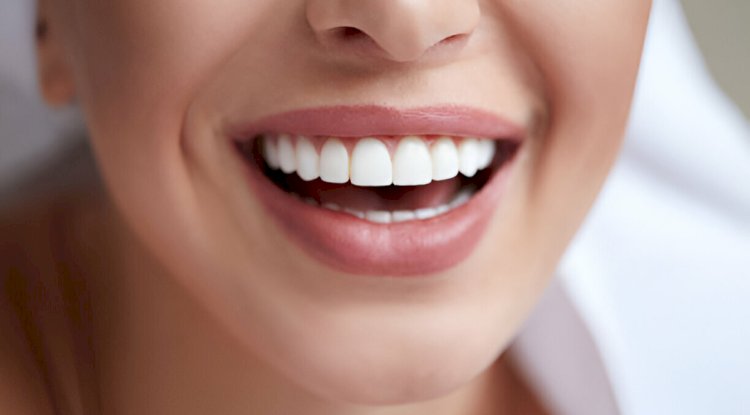 Top Cosmetic Dentists in Keller: What Makes Keller Family Dental Stand Out?