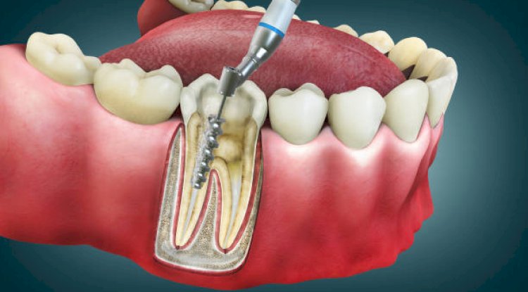 Dentist in Mumbai: Your Guide to Expert Dental Care