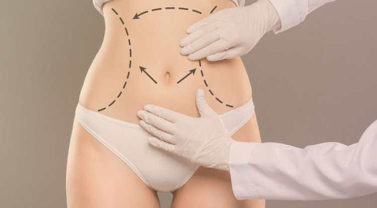 Tummy Tuck Surgery in Dubai - Your Path to a Confident You